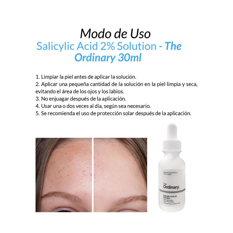 Salicylic-Acid-2--Solution---The-Ordinary-30ml