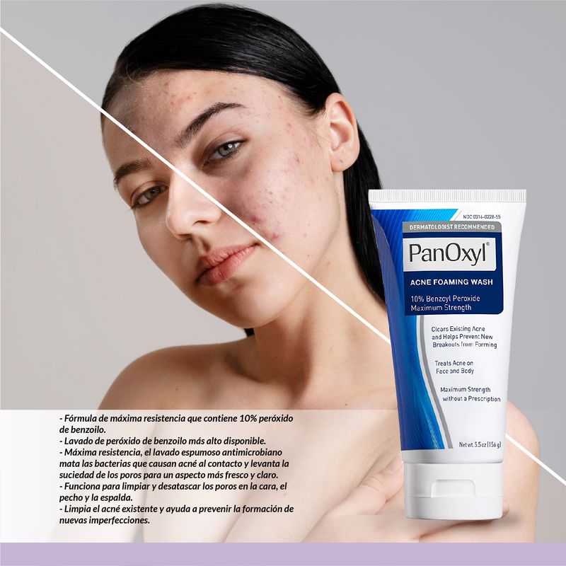 Foaming-Acne-Wash-Maximum-Strength-10--Benzoyl-Peroxide---PanOxyl-156-gr