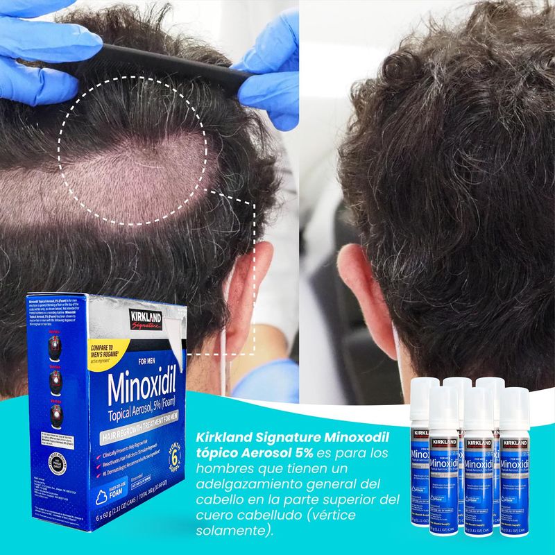 2-Minoxidil-Espuma-Kirkland-para-Barba-y-Cabello-60ml