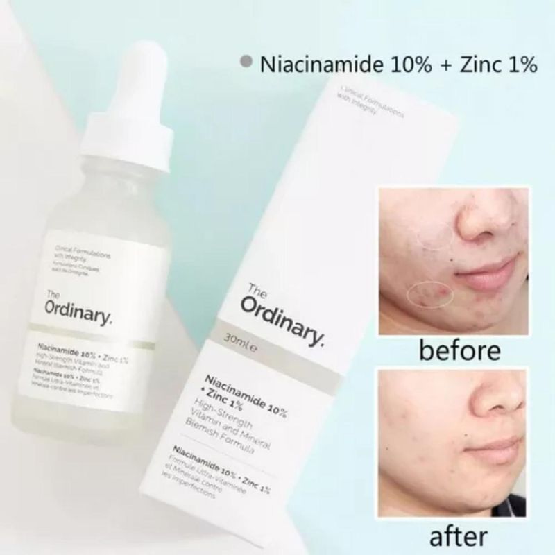 Niacinamide-10--Zinc-1--The-Ordinary-x-60-ml