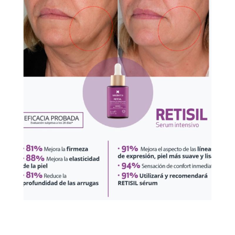 Sesderma-RETISIL-Serum-Intensivo-30ml