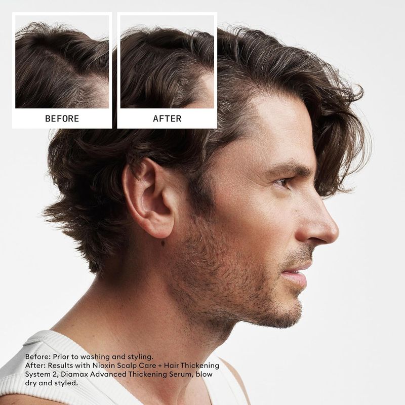Nioxin-2-Shampoo-Densificador-para-Cabello-Natural-1000ml